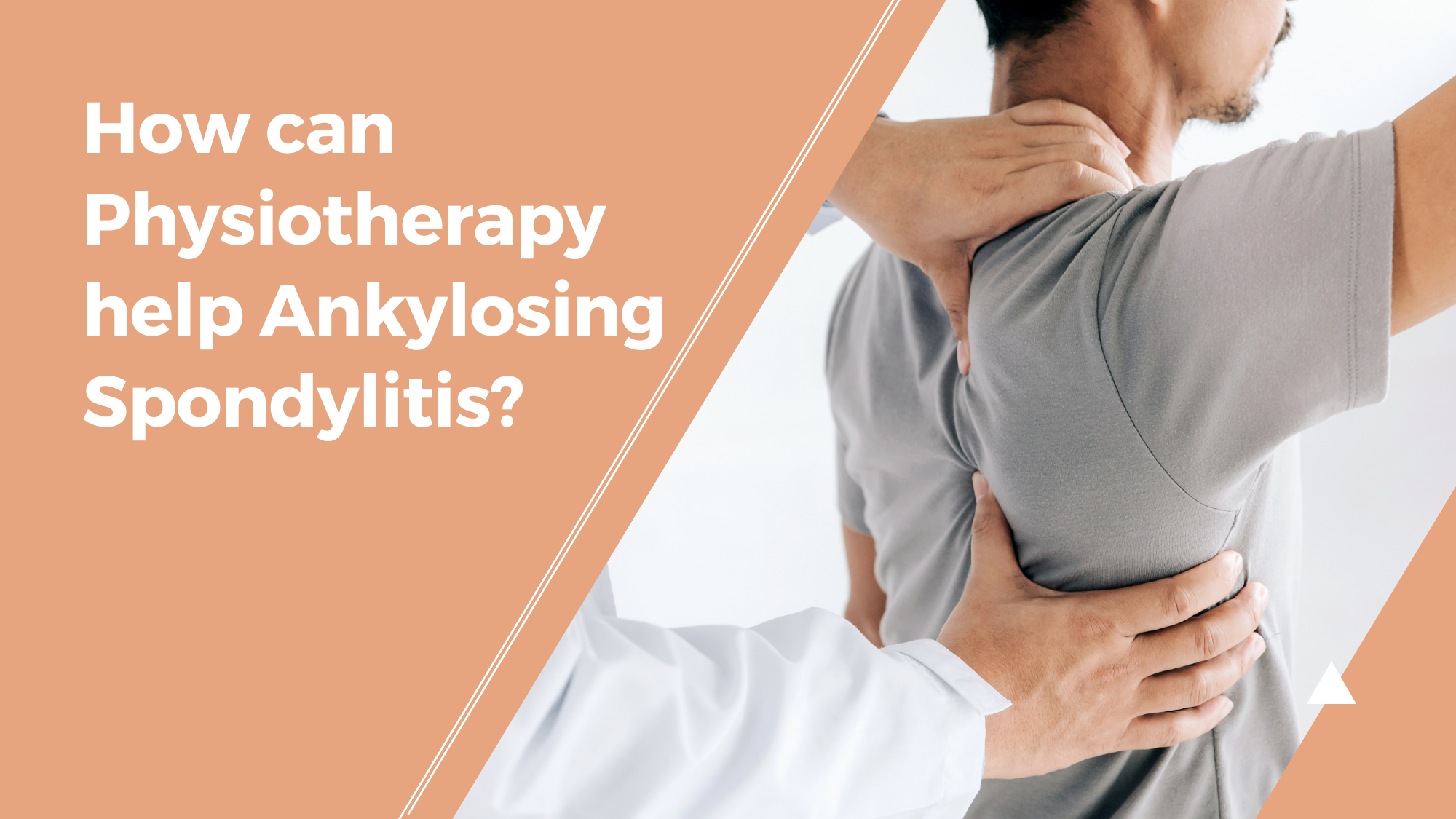 How can Physiotherapy help Ankylosing Spondylitis?